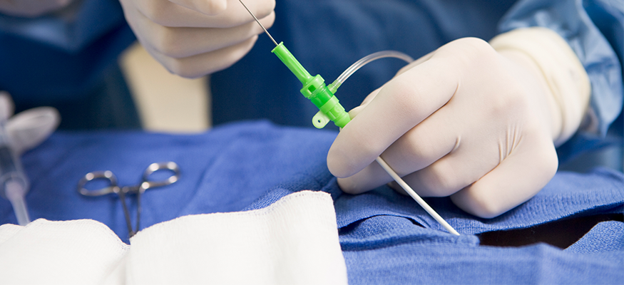 A surgeon performing a catheterization 