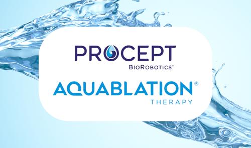 Aquablation graphic