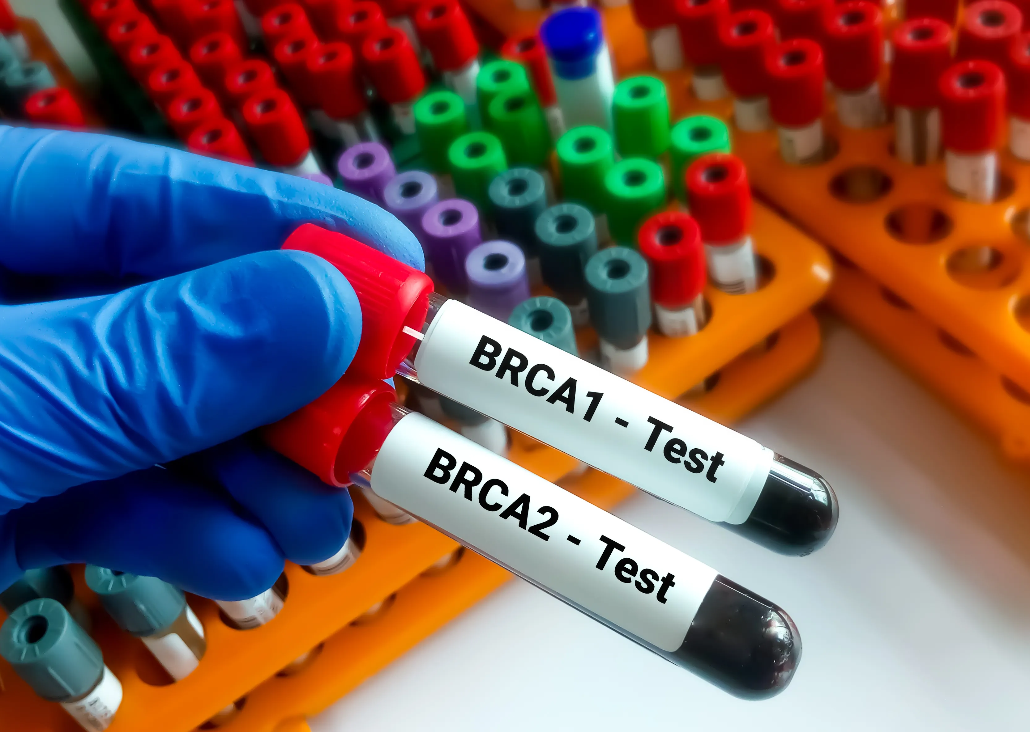 genetic testing for breast cancer